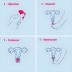 Copo Menstrual - 3 Cores - Tamanho S