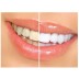 White Light - Dental White – Branqueador Dentário